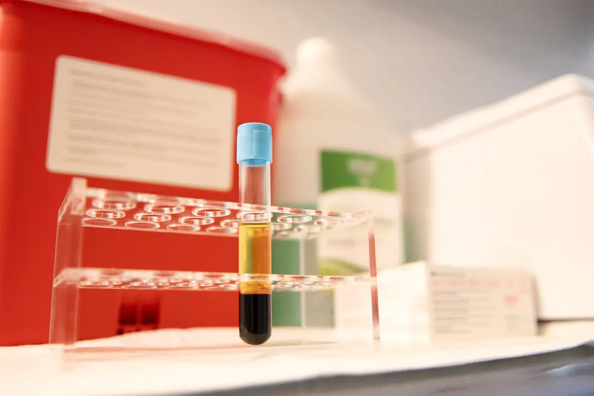 Blood samples in the on-site draw station at Healing Advanced Solutions, one spun to serum for functional lab work