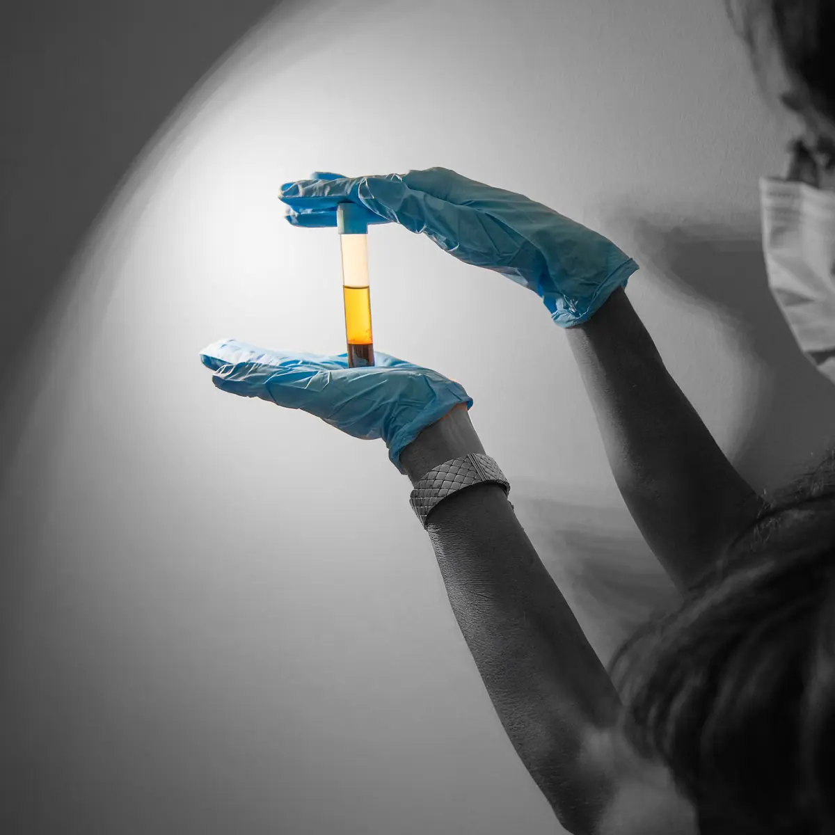 A vial of platelet-rich plasma held up for inspection after spinning at Healing Advanced Solutions