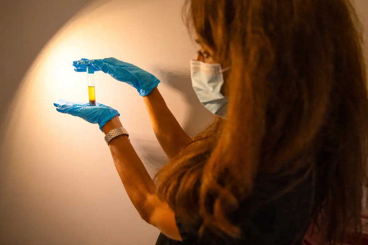 A gloved hand holds a vial of platelet-rich plasma after spinning at Healing Advanced Solutions
